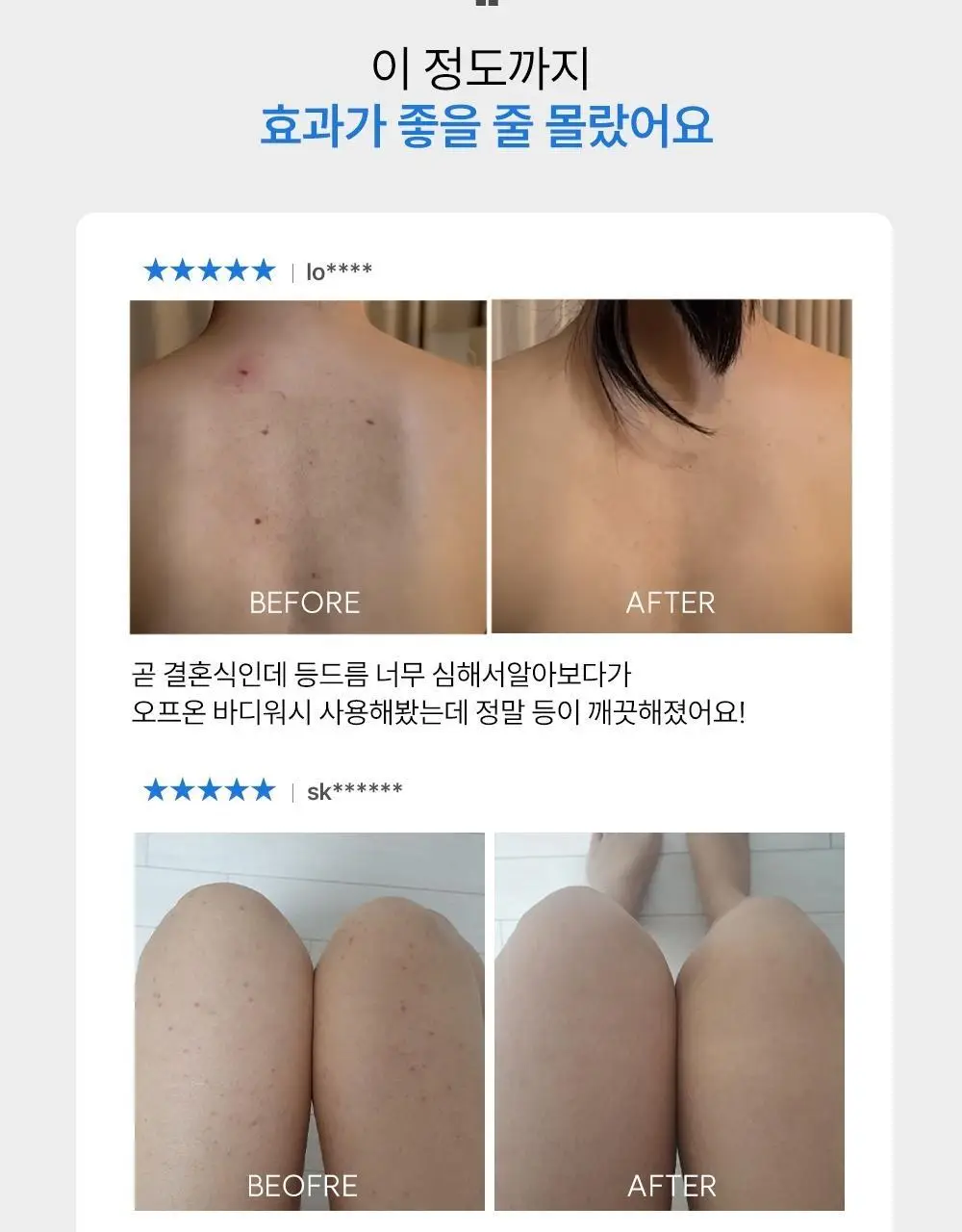 [트러블 흔적 7일개선] 오프온 등드름 바디워시(유수분밸런스케어) 상세페이지 11